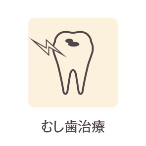 虫歯治療